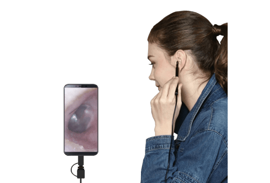 VisualCleanX Herramienta de limpieza de oídos